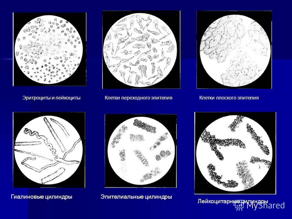 Спермограмма: патология головки – дефекты, аномалии и атипия, другие патологические формы