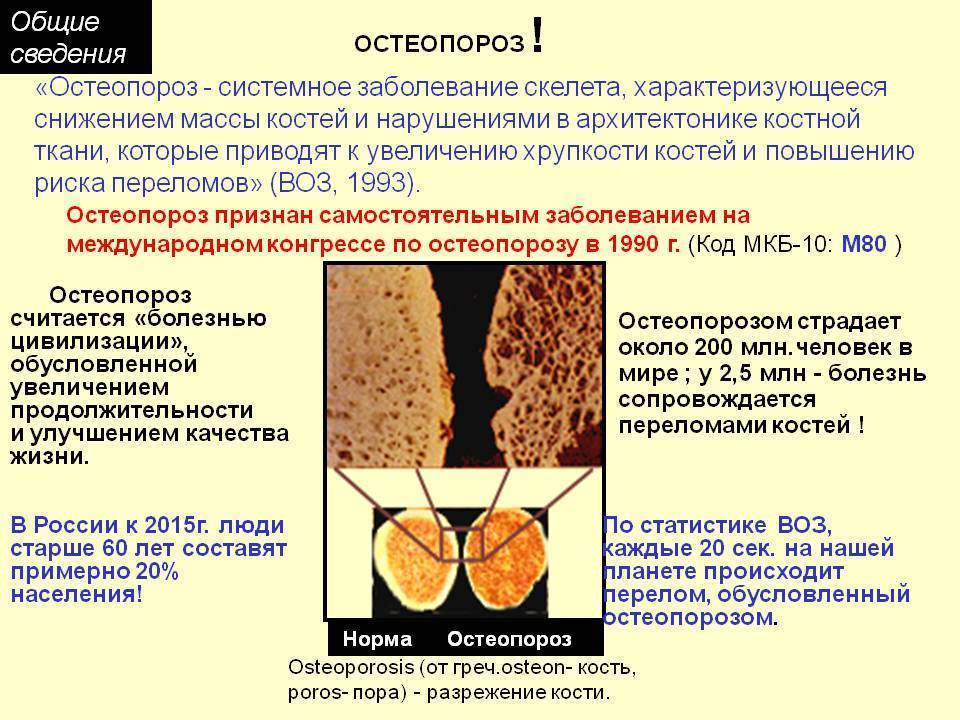Как не пропустить остеопороз у детей. - блог врача олега конобейцева