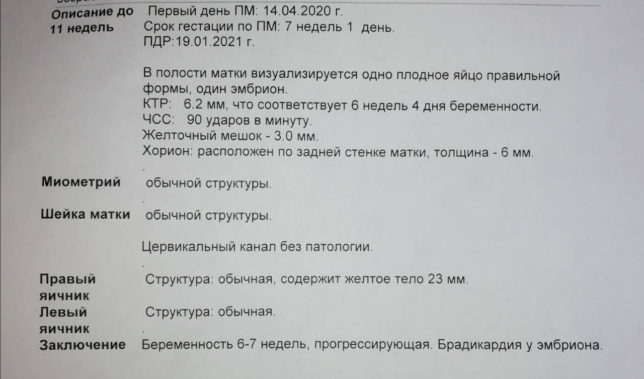 Брадикардия плода: лечение и последствия. брадикардия плода: причины, симптомы и лечение