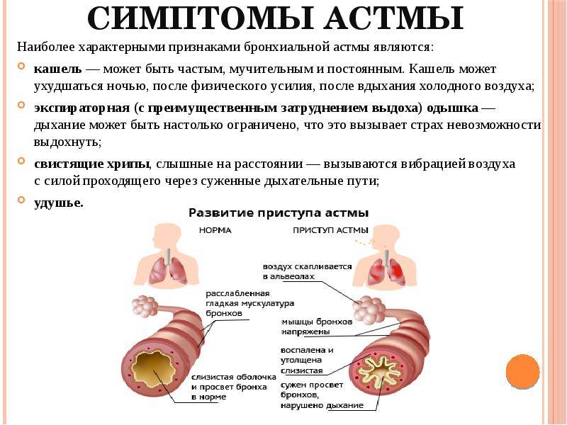 Бронхиальная астма у детей - симптомы болезни, профилактика и лечение бронхиальной астмы у детей, причины заболевания и его диагностика на eurolab