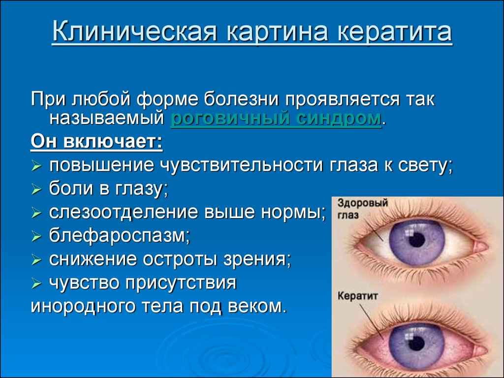 Конъюнктивит у детей 2 лет: симптомы и эффективное лечение